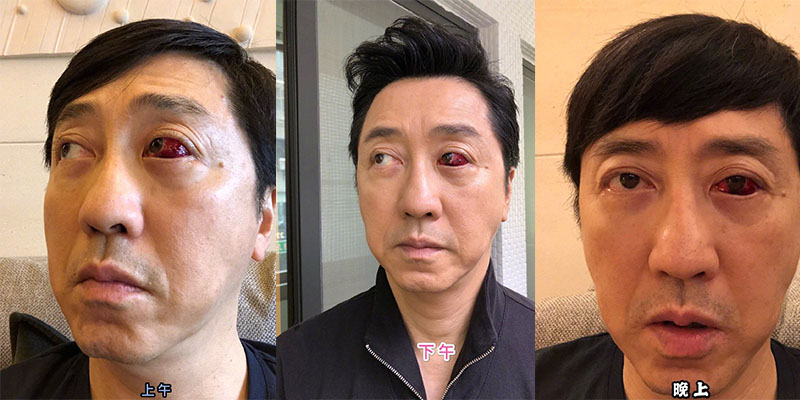 庾澄庆血眼吓懵网友