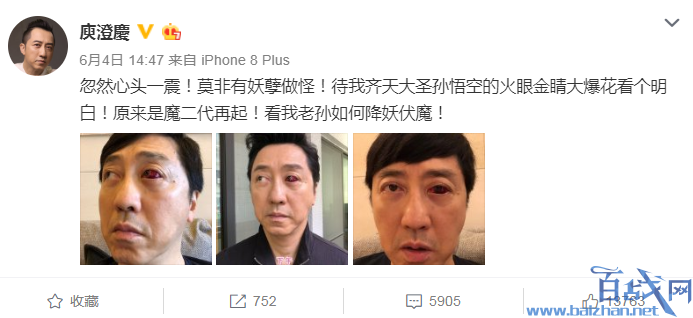 庾澄庆血眼吓懵网友，身体都成这样了哈林哥还有心情开玩笑